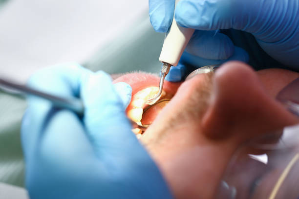 Best Pediatric Emergency Dentist in Bernie, MO