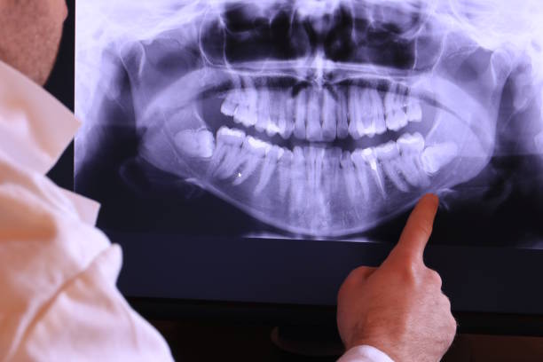 Best Emergency Broken Tooth Repair in Bernie, MO