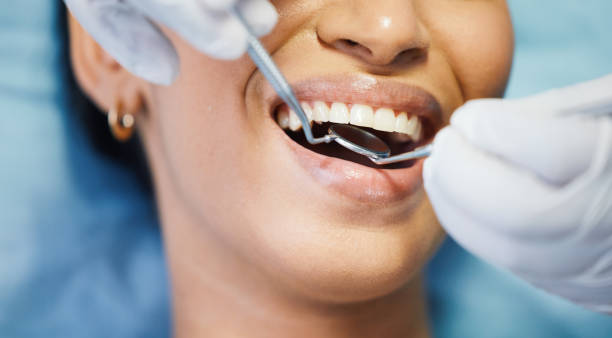 Best Emergency Broken Tooth Repair in Bernie, MO